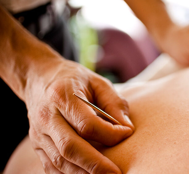 Acupuncturist placing a needle in a patient's shoulder